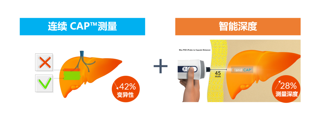 APASL2023 | SmartExam by FibroScan®在NAFLD中的应用优势