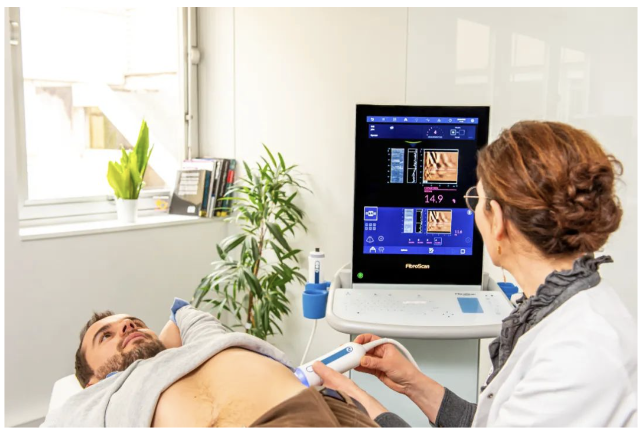 爱科森®学院专栏 | FibroScan®全球指南与共识推荐介绍（门静脉高压篇）