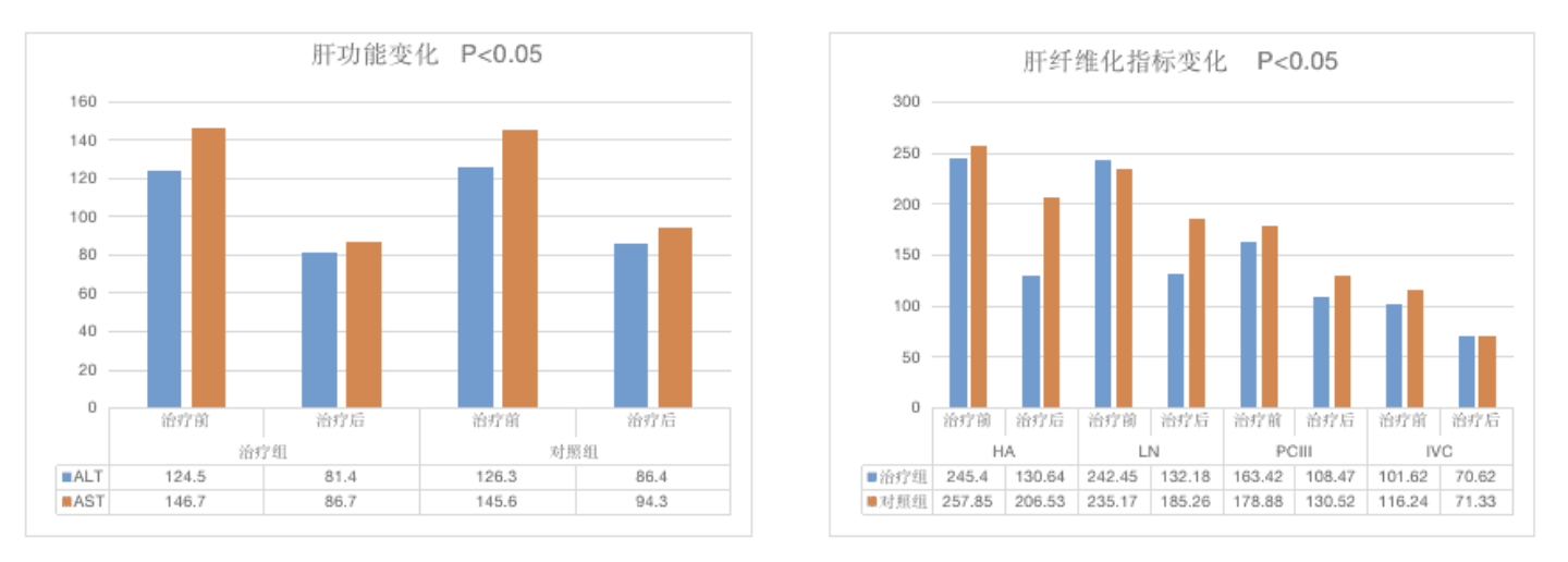 复方鳖甲软肝片治疗酒精性肝硬化疗效显著